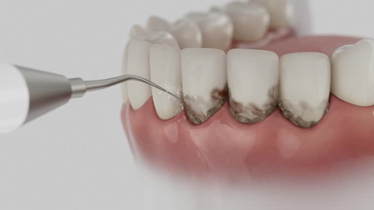 Reliable Tooth Extraction contractor in Harrison County County, KY by Dentist Open Now